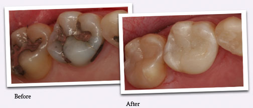 Before and after smile photos.