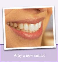 Why a new smile?